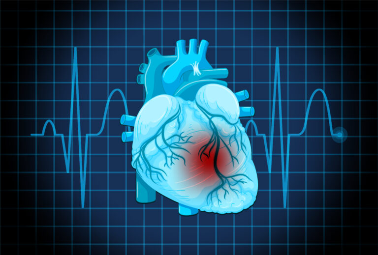 हार्ट अटैक (Heart Attack) – कारण, लक्षण और तत्काल उपाय